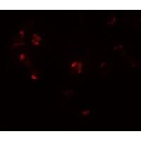 IHC-plus™ ZNF821 Antibody