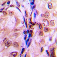EIF4EBP1 / 4EBP1 Antibody (phospho-Thr69)
