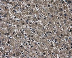 AKR1A1 Antibody (clone OTI6E3)