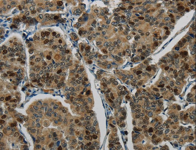 LIG1 / DNA Ligase 1 Antibody