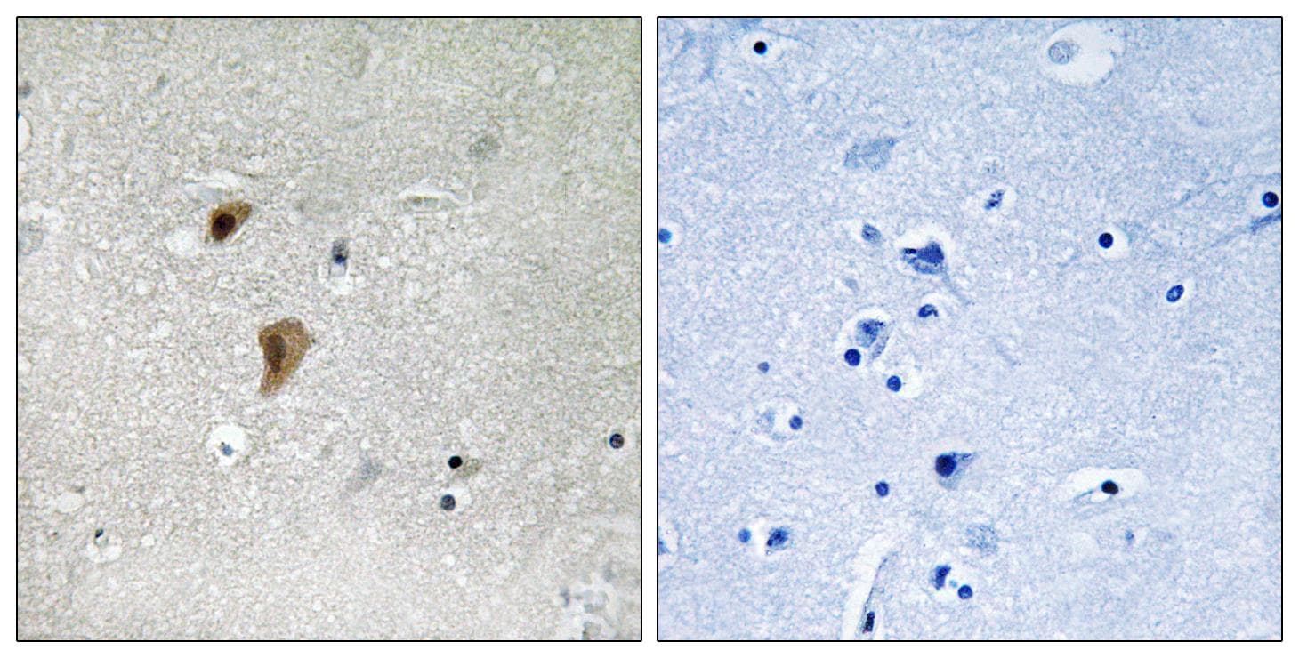 HSF1 Antibody (phospho-Thr142)
