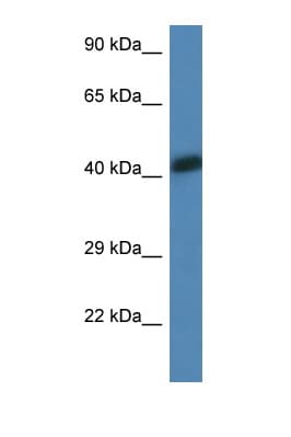 Polyclonal Rabbit anti-Human ACTA1 / Skeletal Muscle Actin Antibody (aa50-99, WB)