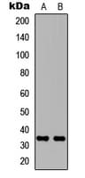 CA8 / Carbonic Anhydrase VIII Antibody (Internal)