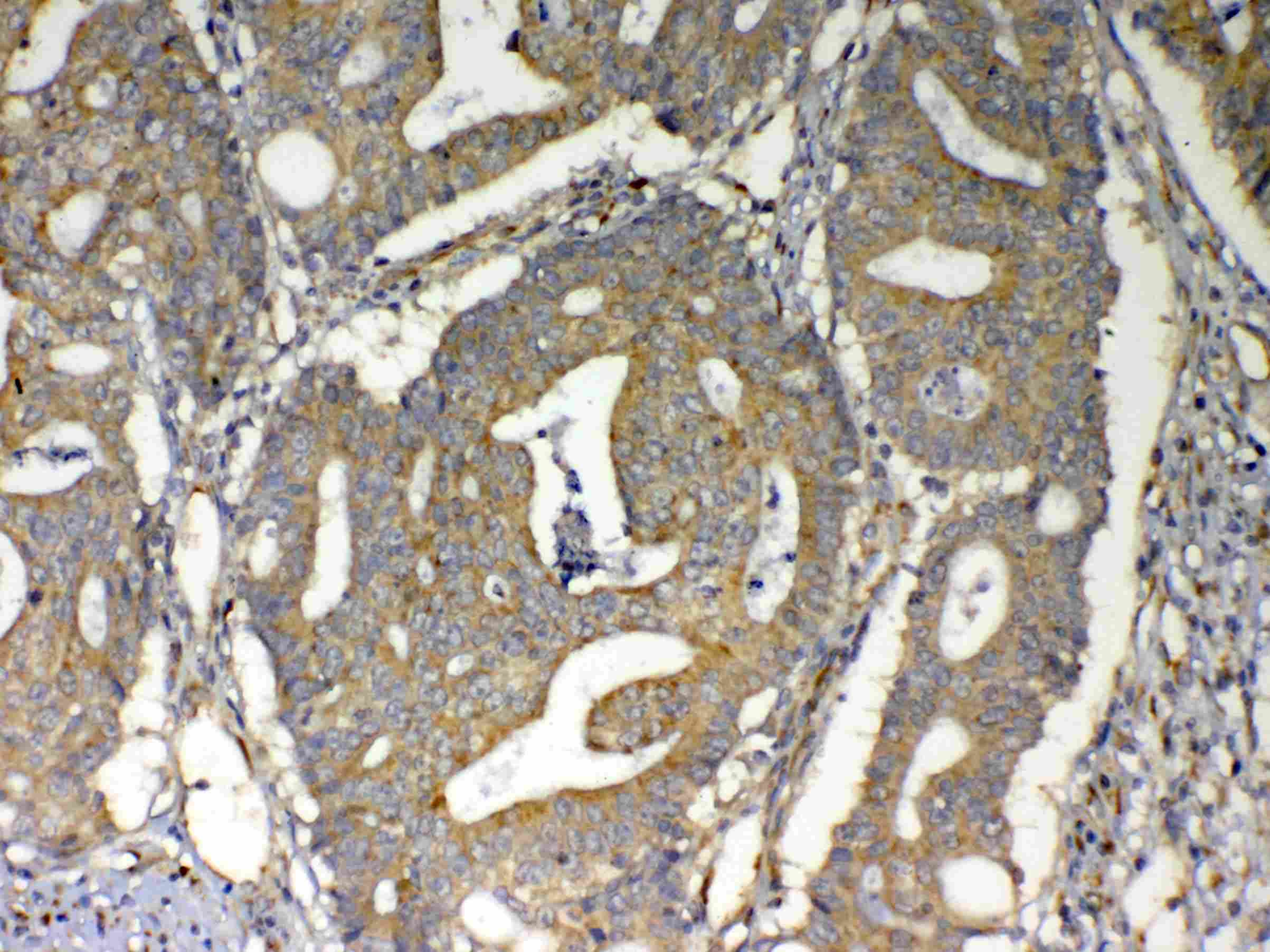 VISA / MAVS Antibody