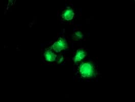 TMPRSS5 Antibody (clone OTI4A11)