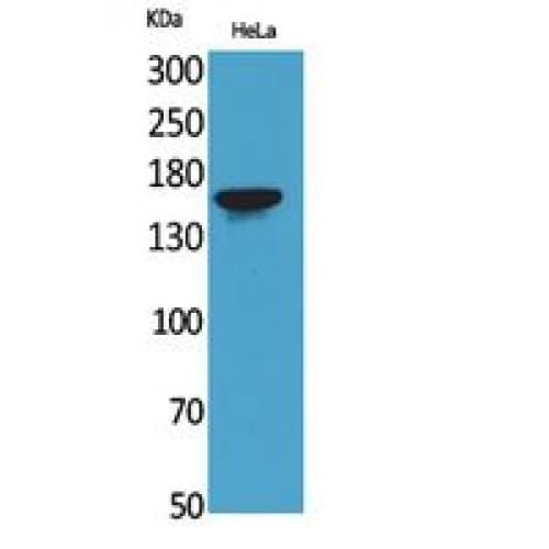 JAG1 / Jagged 1 Antibody (981-1030 aa, Internal)