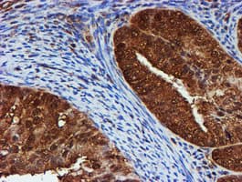 PSMB9 Antibody (clone OTI2B6)