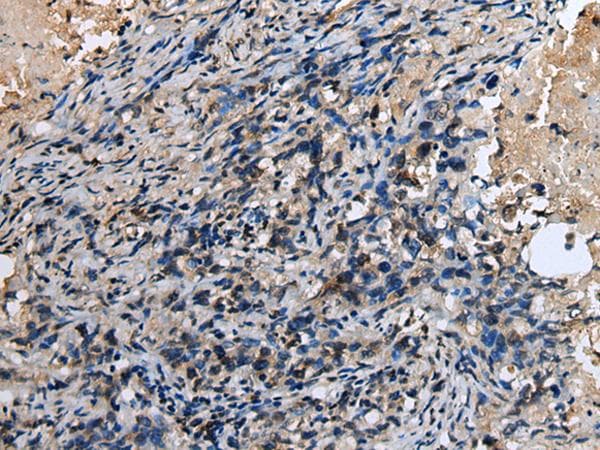 Polyclonal Rabbit anti-Human ABHD14B Antibody (IHC, WB)