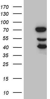 ELL / MEN Antibody (aa302-621, clone OTI1C12)