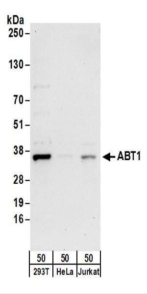 Polyclonal Rabbit anti-Human HABT1 / ABT1 Antibody (aa1-50, WB)