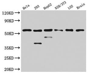 PKM / Pyruvate Kinase, Muscle Antibody