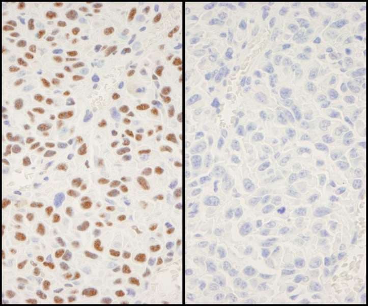 Polyclonal Rabbit anti-Human XRCC1 Antibody (phospho-Ser518 / phospho-Thr519/523, IHC, IF)