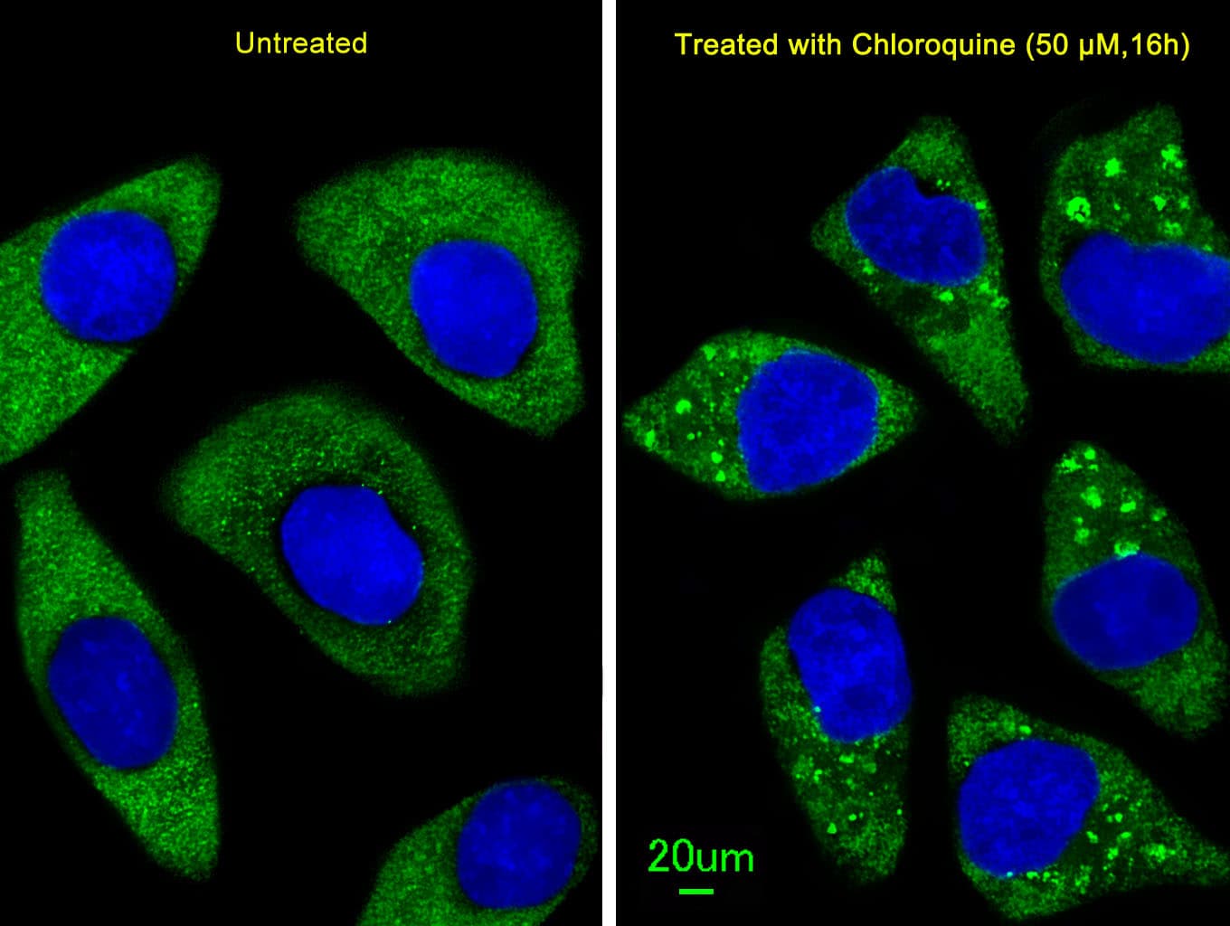 Apg7 / ATG7 Antibody (aa540-569)
