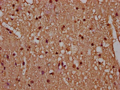 Polyclonal Rabbit anti-Human HIST1H4I Antibody (IHC)