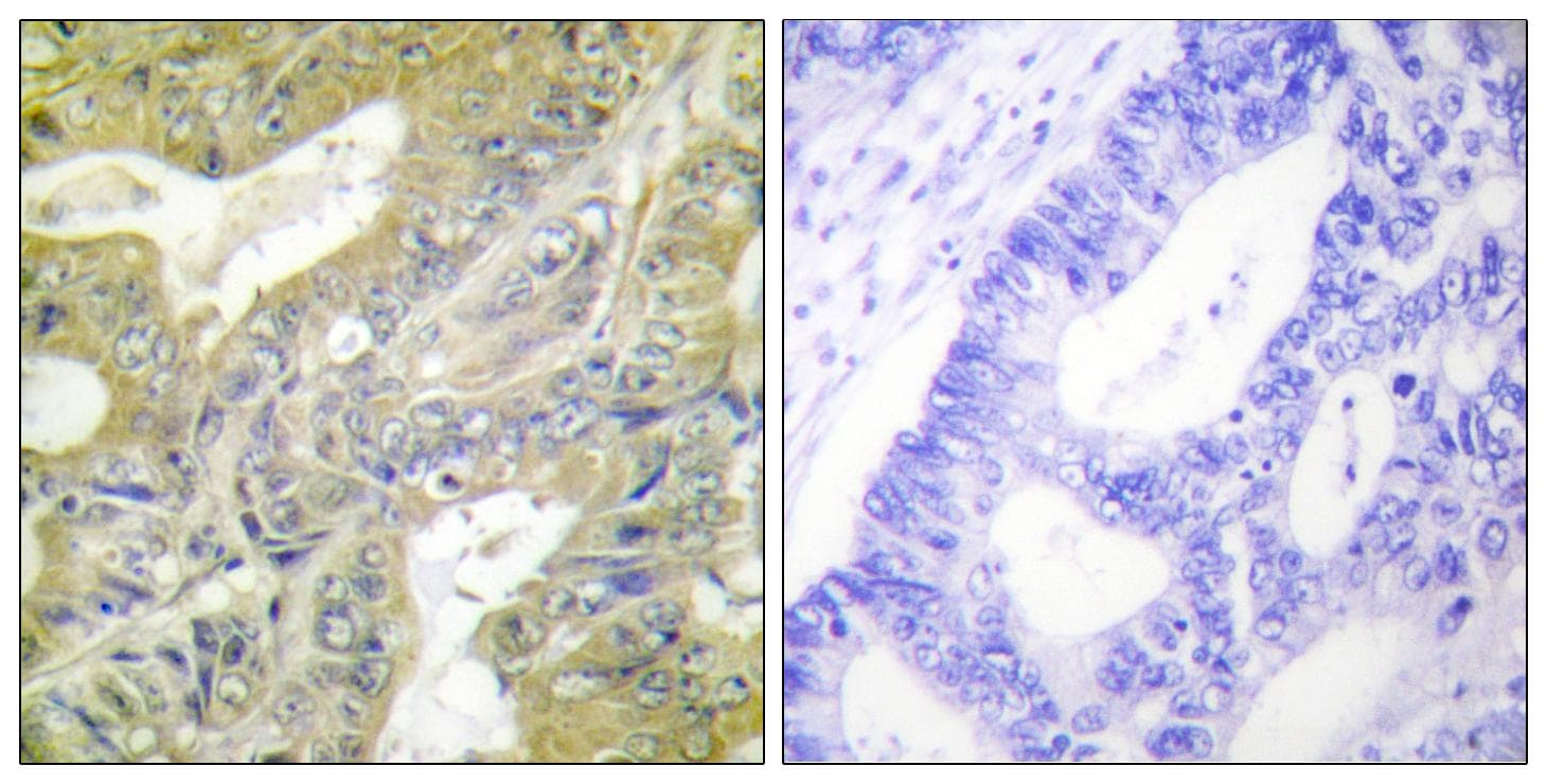 HEXB Antibody