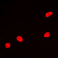 MEF2A / MEF2 Antibody (C-Terminus)