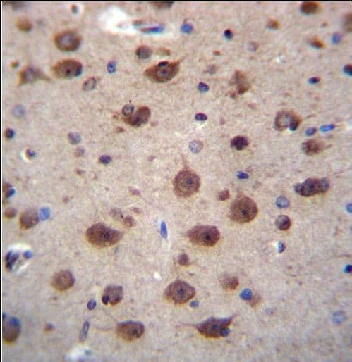 Polyclonal Rabbit anti-Human PNKD Antibody (aa42-70, IHC, WB)