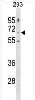 Polyclonal Rabbit anti-Human GABRE Antibody (aa66-94, WB)