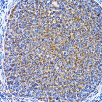 MAP1LC3A / LC3A Antibody