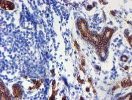 ERBB2 / HER2 Antibody (aa676-1255, clone OTI11A7, Carrier-free)