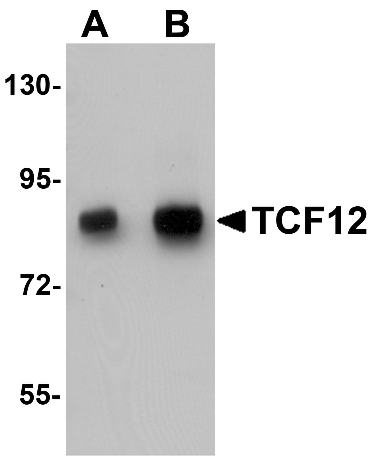 IHC-plus™ Polyclonal Rabbit anti-Human TCF12 / HEB Antibody (IHC, WB)