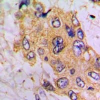 Polyclonal Rabbit anti-Human GLCNE / GNE Antibody (IHC, WB)