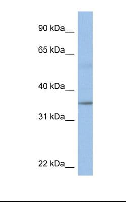 Polyclonal Rabbit anti-Human KCTD4 Antibody (aa151-200, WB)
