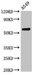 PODXL / Podocalyxin Antibody
