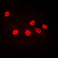 PathPlus™ IKZF1 / IKAROS Antibody