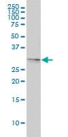 Monoclonal Mouse anti-Human TPM4 Antibody (clone 4E4-1D2, IHC, IF, WB)