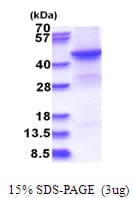 Human BHMT2 Protein (Recombinant His)