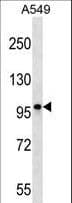 Polyclonal Rabbit anti-Human CCDC141 Antibody (aa1-30, WB)