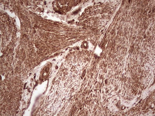 UBE2D2 / UBCH5B Antibody (clone OTI1D11)