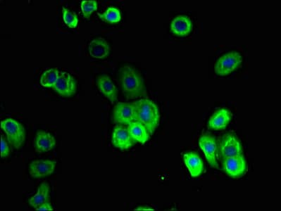 SLC10A2 / ASBT Antibody