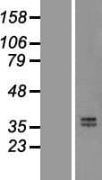 Osteoglycin / Mimecan Protein (Over-Expression Lysate Myc-DDK (Flag))
