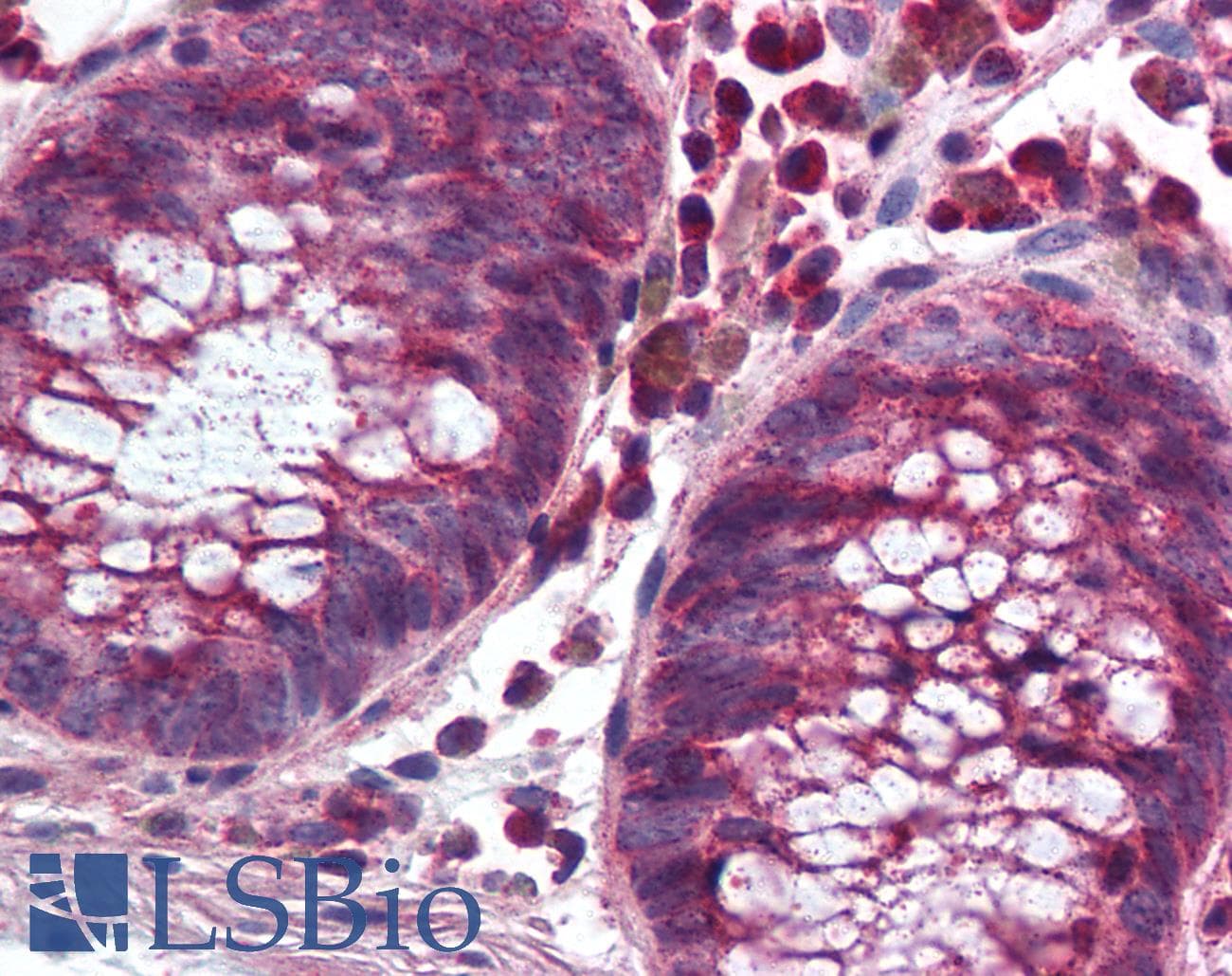 IHC-plus™ NOX1 Antibody (C-Terminus)