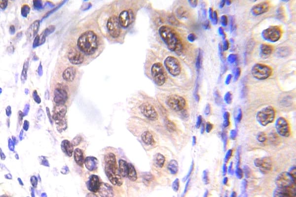 STAT1 Antibody (phospho-Ser727)