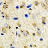 KCNJ11 / Kir6.2 Antibody