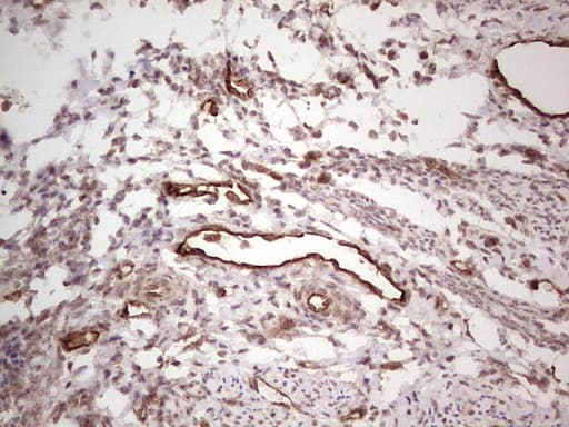 PROCR / EPCR Antibody (aa1-210, clone OTI6B10)
