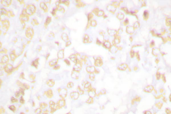XRCC6 / Ku70 Antibody (Arg586)