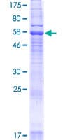 Human YIPF3 Protein (Recombinant GST)