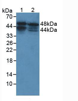 PathPlus™ ACPP / PAP Antibody (aa217-386)