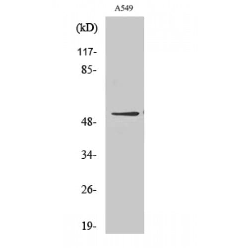 Polyclonal Rabbit anti-Human GIPR / GIP Receptor Antibody (60-140 aa, Internal, IHC, IF, WB)