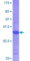 Human TRPM7 Protein (Recombinant GST, N-terminus)