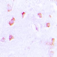 COL20A1 / Collagen XX Antibody (C-Terminus)