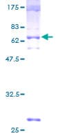 Human SLC29A2 / ENT2 Protein (Recombinant GST)