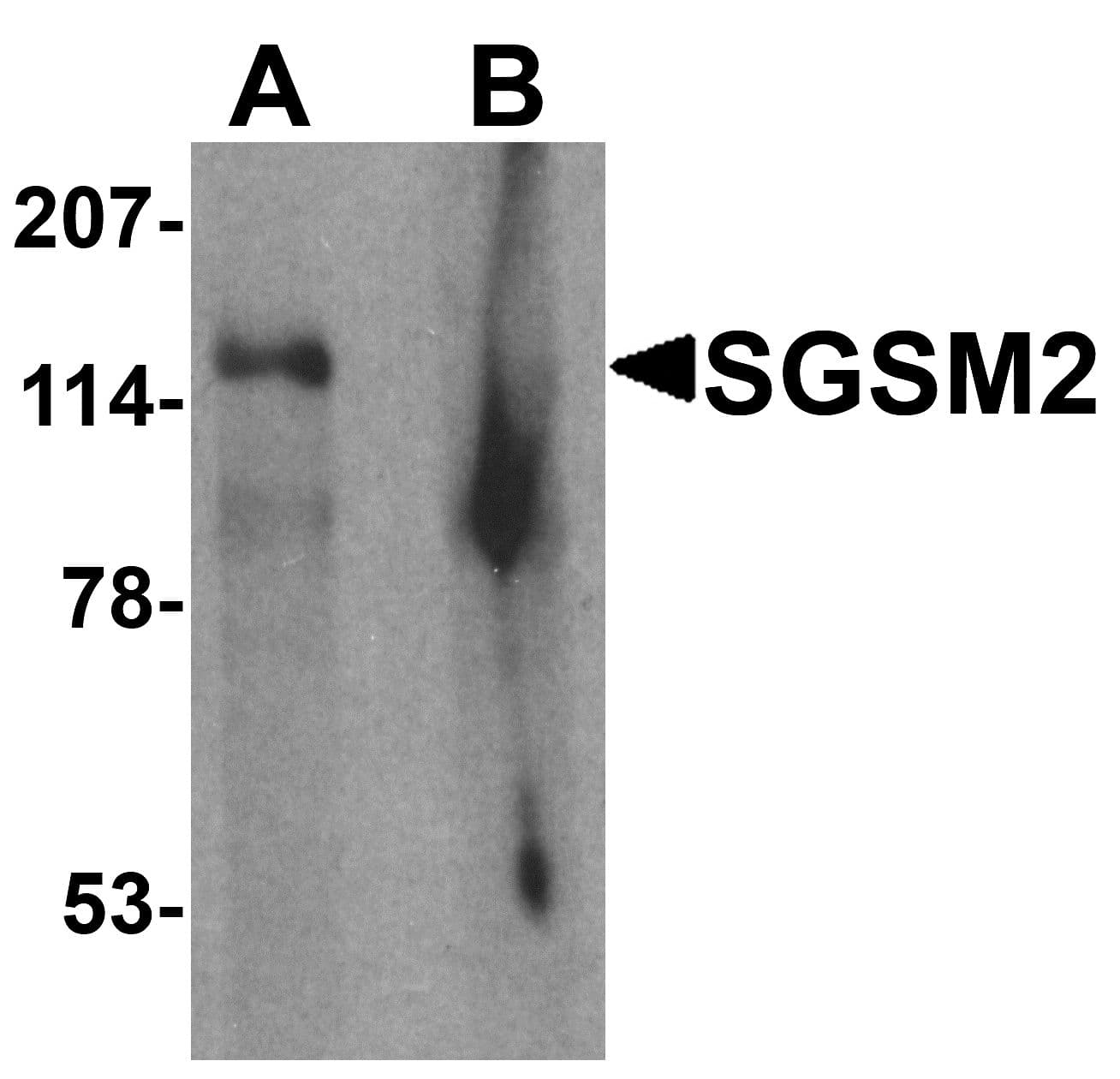IHC-plus™ SGSM2 Antibody