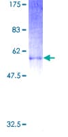 Human Proenkephalin / PENK Protein (Recombinant GST)