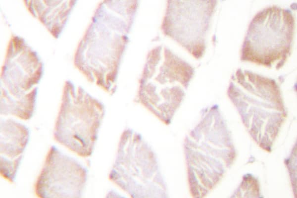 AKT1 Antibody (Pro125)