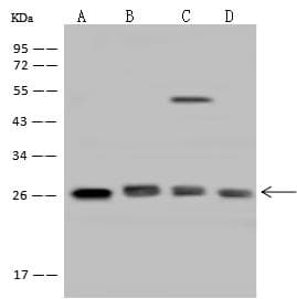 Polyclonal Rabbit anti-Human ARHGDIA / RHOGDI Antibody (IHC, WB)